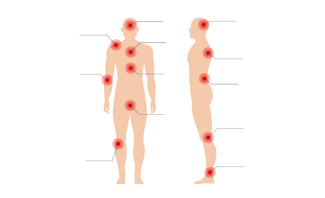 人身体痛点标注指示图人体轮廓矢量医学插图上圈出痛苦的红色斑点标识