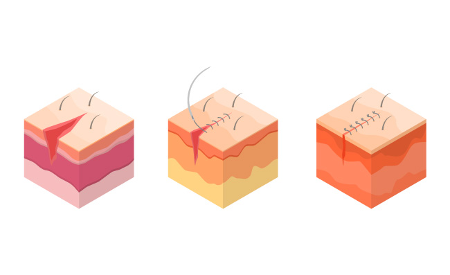 手术伤口缝合图标